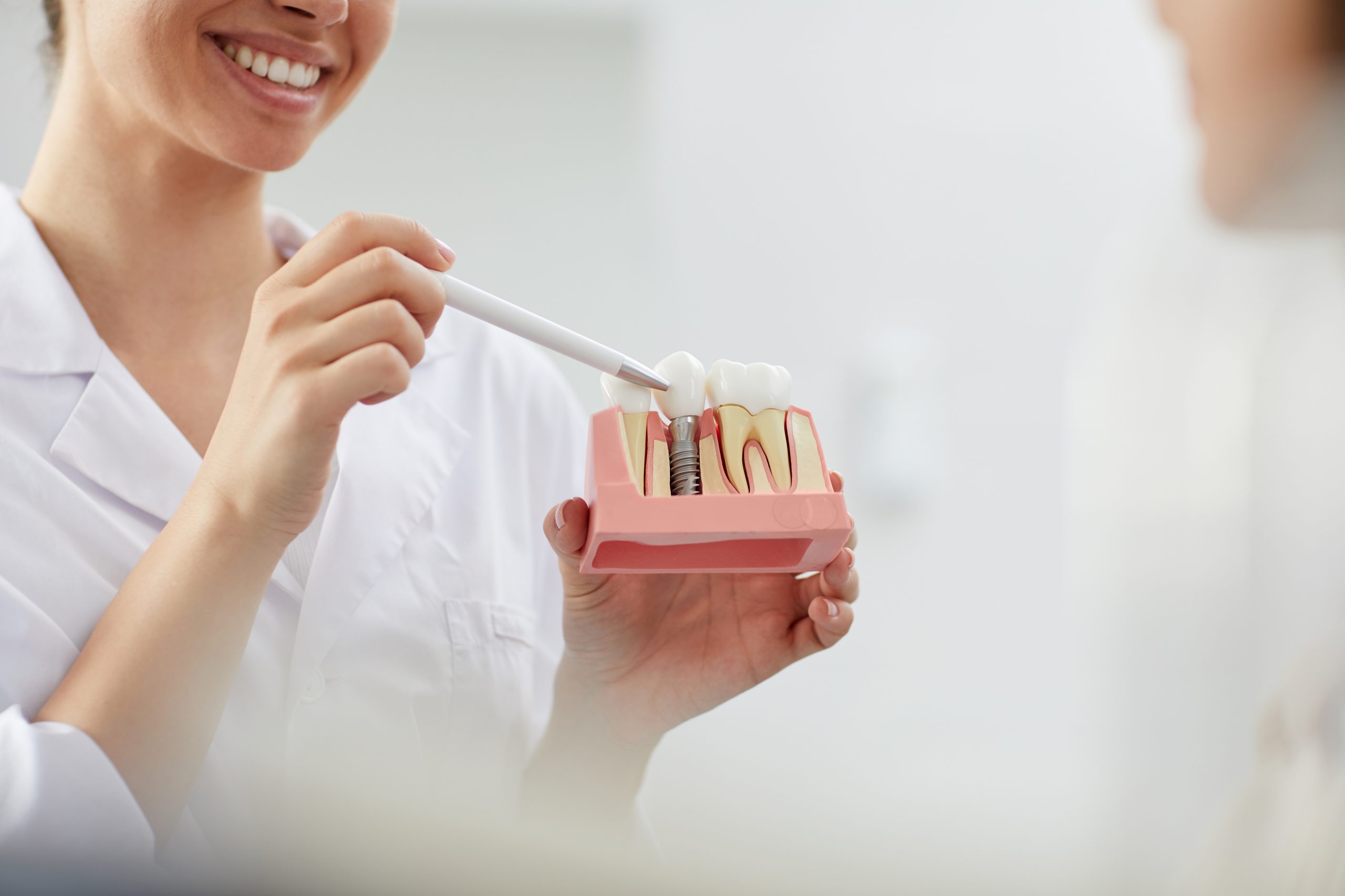 Are Dental Implants Worth Your Time and Money?